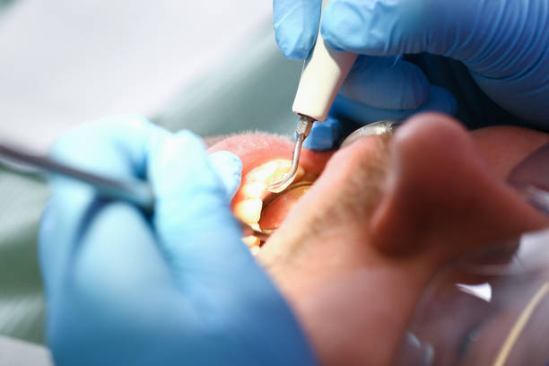 Best Weekend Emergency Dentist in Rouse, CA